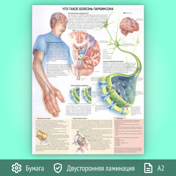 Плакат «Что такое болезнь Паркинсона?» (ЗОЖ-29, 1 лист, А2)
